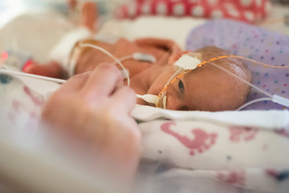 Infant receiving advanced care in the NICU at Peyton Manning Children’s Hospital.