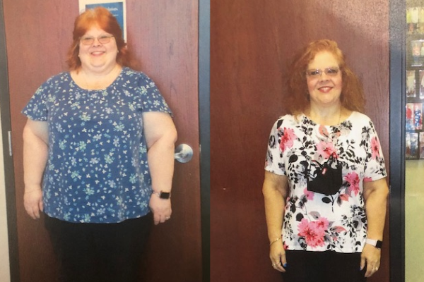 Bariatric surgery saved my life. But it wasn't the 'easy' way out of weight  loss
