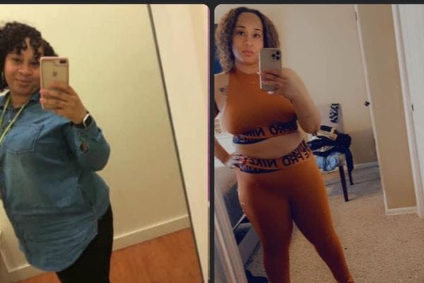 Ascension Bariatrics patient Shamone E before and after her medical weight loss program
