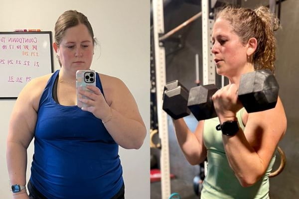 Rutherford Bariatric Center surgery patient before and after 