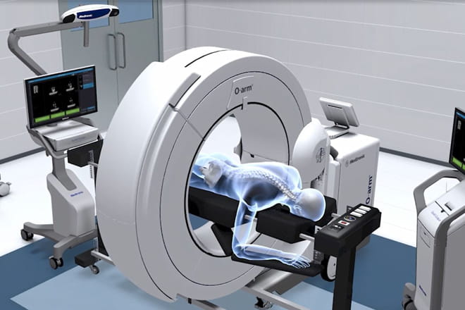 Ascension Providence is now the first facility in Mobile to offer the O-arm™ system with StealthStation™ navigation, which gives surgeons real-time 3D images during surgery. The O-arm™ system can be used in a variety of procedures including spine, brain and orthopedic cases.