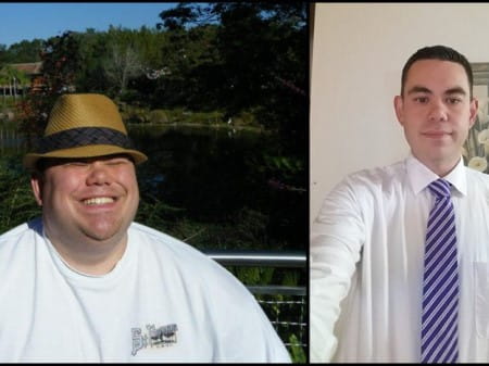 Jim Paras weight loss with Ascension St. Agnes Bariatric Surgery Center.