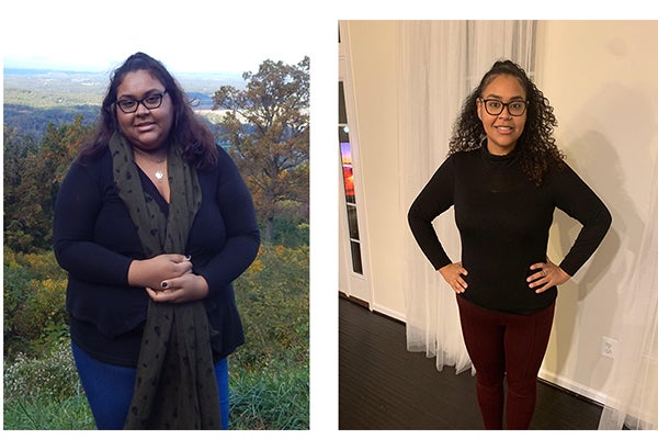 MD_saintagnes_bariatrics_janiepatientstory_thumbnail