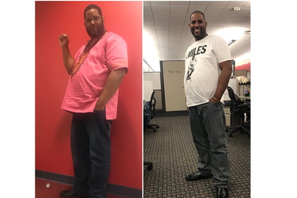 MD_saintagnes_bariatrics_keithpatientstory_thumbnail