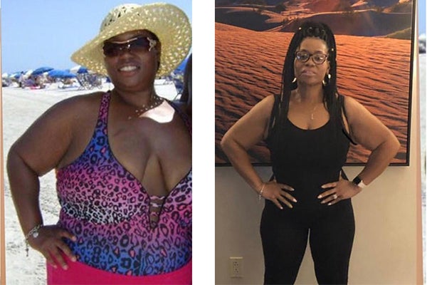 MD_saintagnes_bariatrics_nicolepatientstory_thumbnail