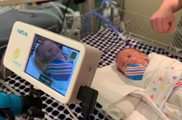 NicView is a bedside camera system that allows families to see real-time images of their babies via internet using a password-protected portal.