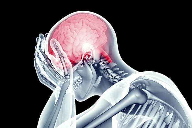 concussion more than bump on head