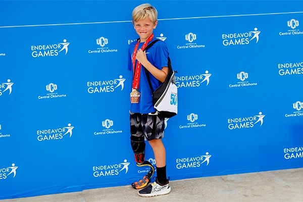 boy with prosthetic leg standing in front of blue background