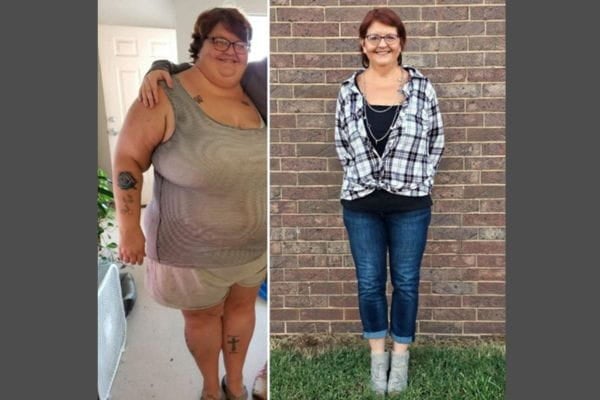 Melody Young before and after 238-pound weight loss