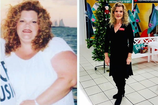 Paula struggled with weight and confidence but transformed her life through bariatric surgery and support. Now 61, 135 lbs, she inspires others to thrive.