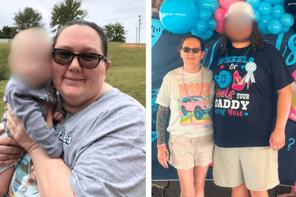 Before and after picture of Wendi after bariatric surgery at Ascension Sacred Heart Comprehensive Wellness Center in Pensacola Florida
