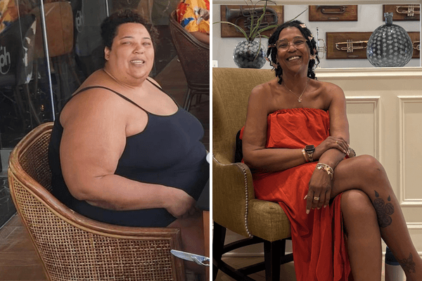 Before and after photo of Murfreesboro resident Larina following her bariatric surgery journey.